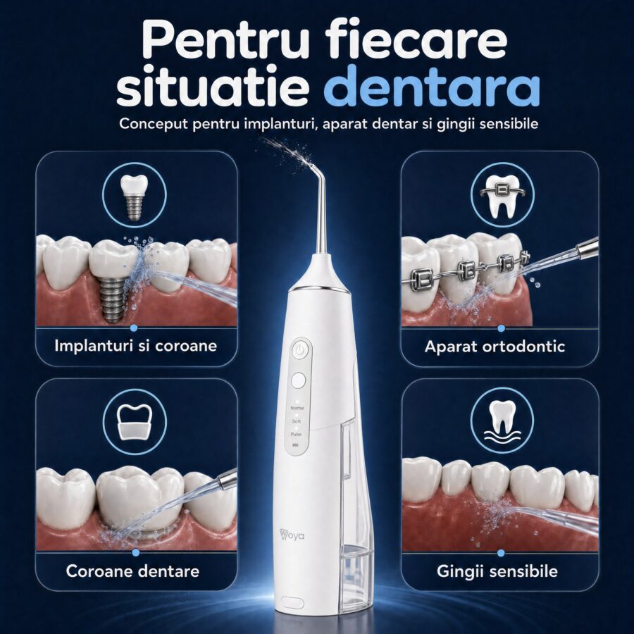 Irigator bucal Woya WH100 300 ml alb, pentru implanturi, aparat dentar și gingii sensibile
