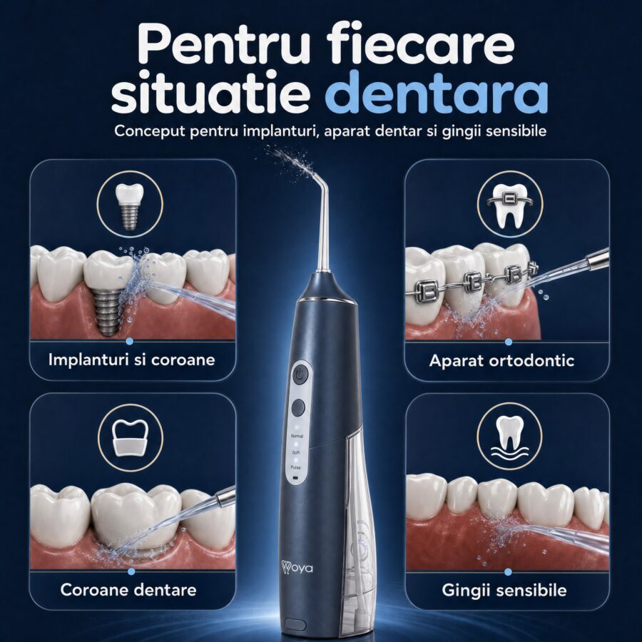 Irigator bucal Woya WH100 300 ml negru, pentru implanturi, aparat dentar și gingii sensibile